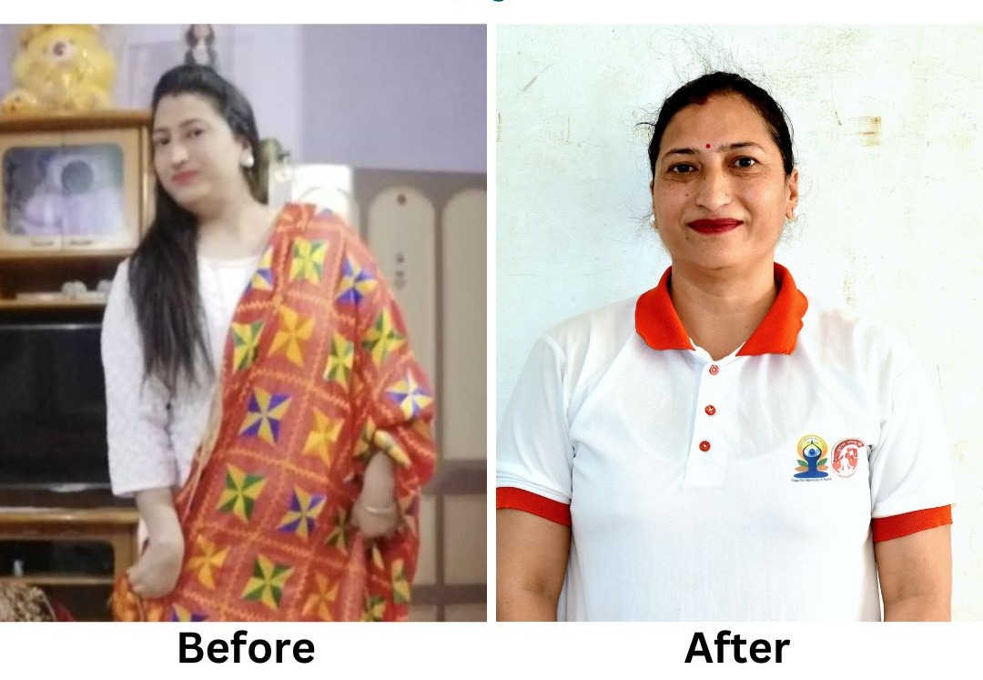વડોદરાના 37 વર્ષીય ગૃહિણીએ દૈનિક યોગ દ્વારા 25 કિલો વજન ઘટાડ્યું