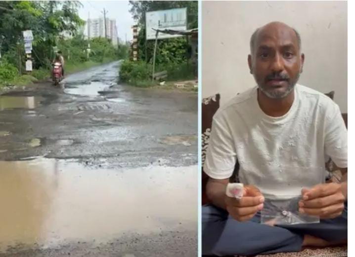 કોર્પોરેશનની બેદરકારીથી સર્જાયો અકસ્માત:બાઈક ચાલકે હાથની એક આંગળી ગુમાવી