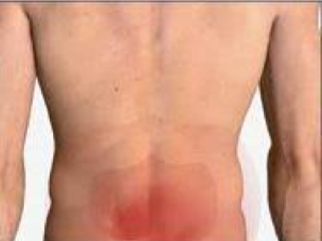 આયુર્વેદિક ઉપચાર : કમરના દુખવા માટેના ઉપાય