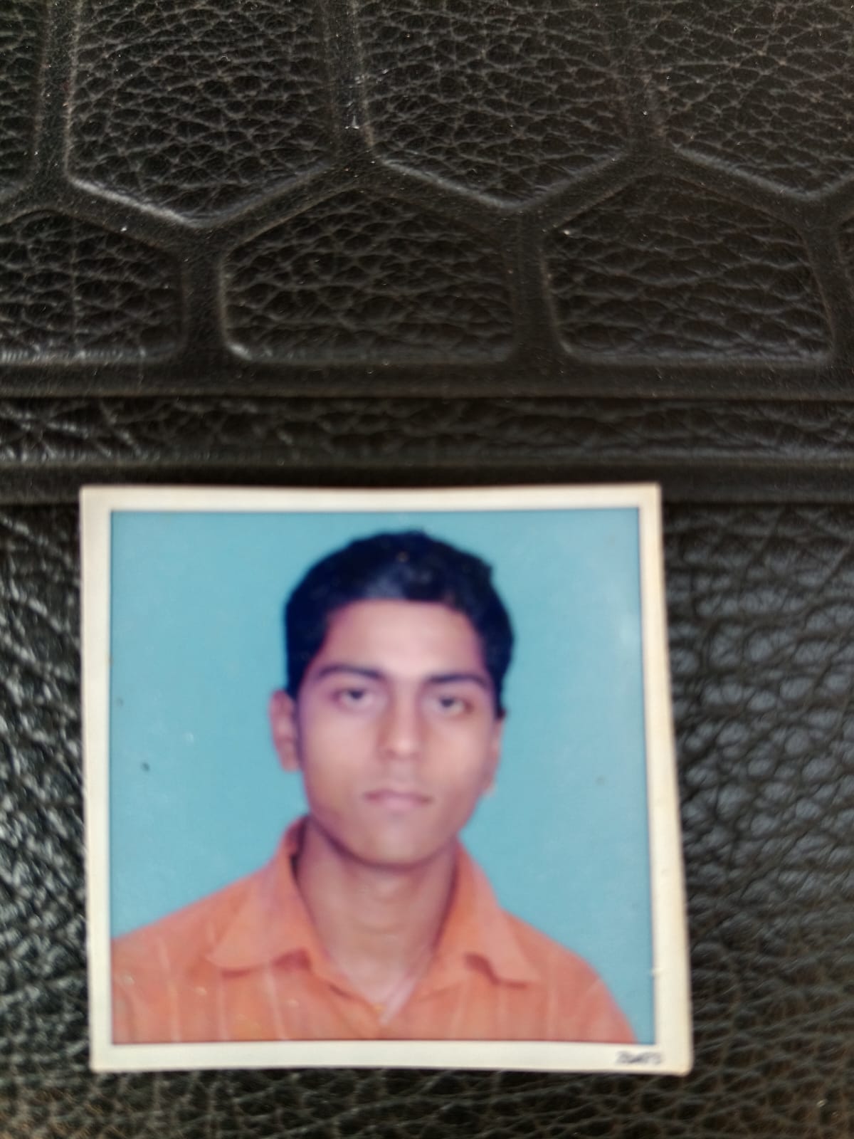 કોર્પોરેશનની બેદરકારી: ખોદેલા ખાડાએ યુવકને મોતની નજીક ધકેલ્યો