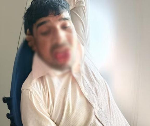 માથાફરેલા પ્રેમીને યુવતીએ ભણાવ્યો પાઠ! બળજબરીથી ચુંબન કરવા જતા યુવતીએ દાંતથી આરોપીની જીભ કાપી નાખી