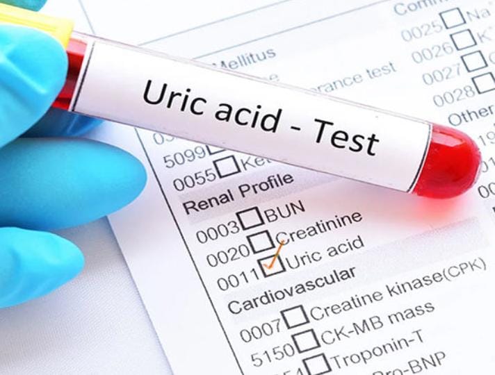 ભારતીય યુવાનોમાં યુરિક એસિડનું ચિંતાજનક પ્રમાણ : ગંભીર બીમારીઓનું જોખમ વધારે છે!