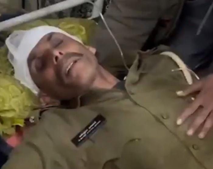 45થી વધુ પોલીસ કર્મી અને ફોરેસ્ટ અધિકારી ઘાયલ: ટોળા દ્વારા વન વિભાગની ગાડીઓને સળગાવી દેવાઈ 